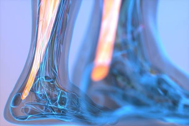 Achilles Tendon Rupture: Surgical vs. Non-Surgical Repair Option